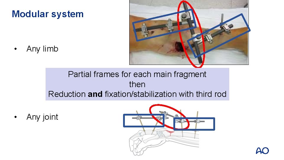 Modular system • Any limb Partial frames for each main fragment then Reduction and