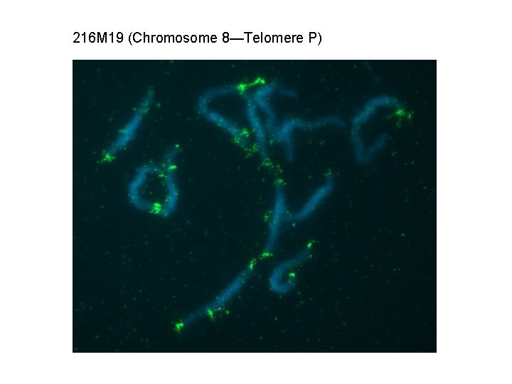 216 M 19 (Chromosome 8—Telomere P) 