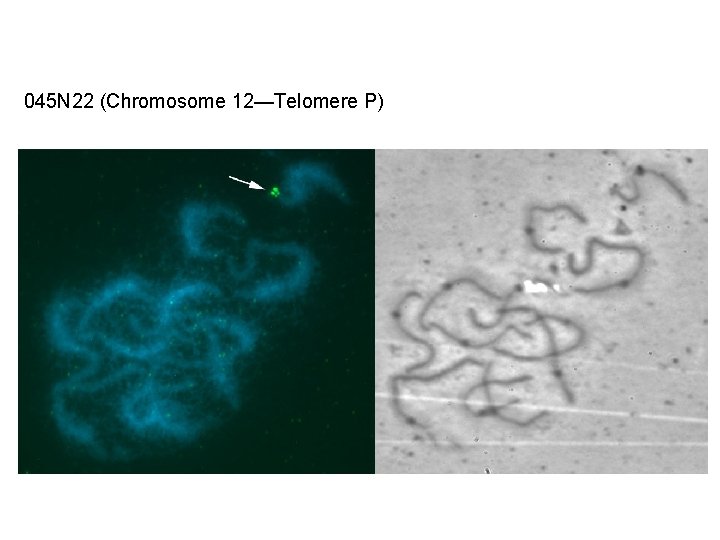 045 N 22 (Chromosome 12—Telomere P) 