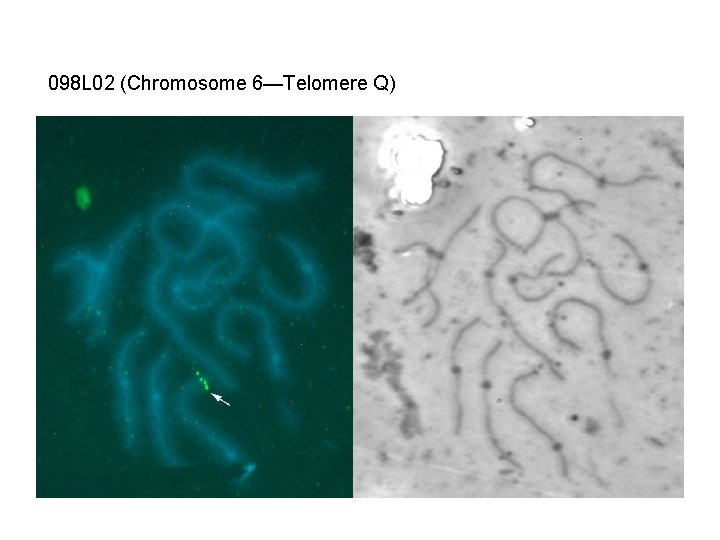 098 L 02 (Chromosome 6—Telomere Q) 