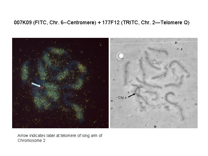 007 K 09 (FITC, Chr. 6 --Centromere) + 177 F 12 (TRITC, Chr. 2—Telomere