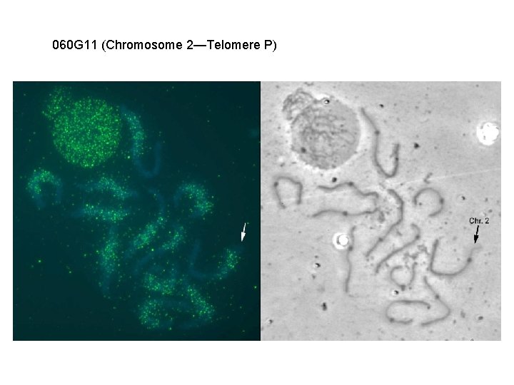 060 G 11 (Chromosome 2—Telomere P) 