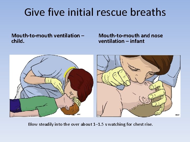 Give five initial rescue breaths Mouth-to-mouth ventilation – child. Mouth-to-mouth and nose ventilation –