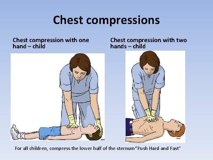 Chest compressions Chest compression with one hand – child Chest compression with two hands