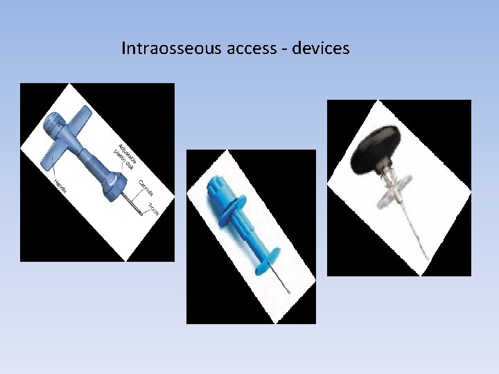 Intraosseous access - devices 