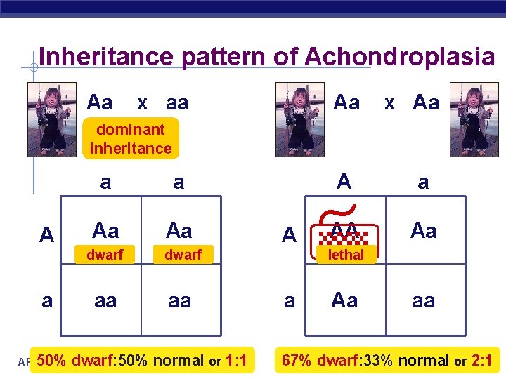 Inheritance pattern of Achondroplasia Aa x aa Aa x Aa dominant inheritance A a