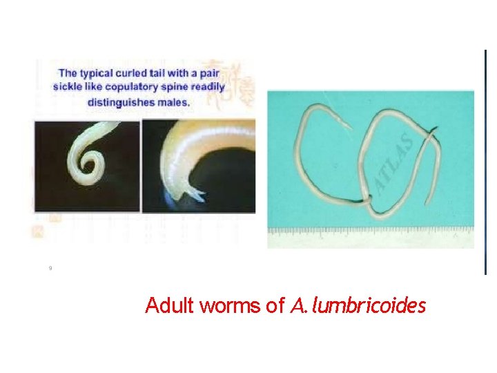 Adult worms of A. lumbricoides 