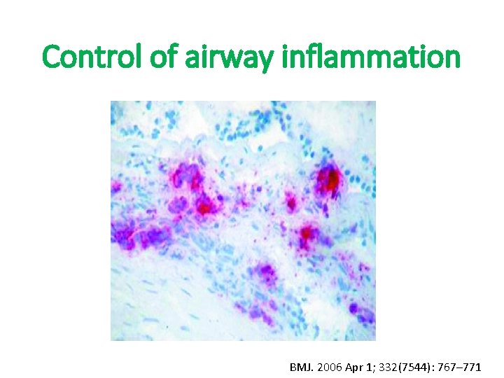 Control of airway inflammation BMJ. 2006 Apr 1; 332(7544): 767– 771 