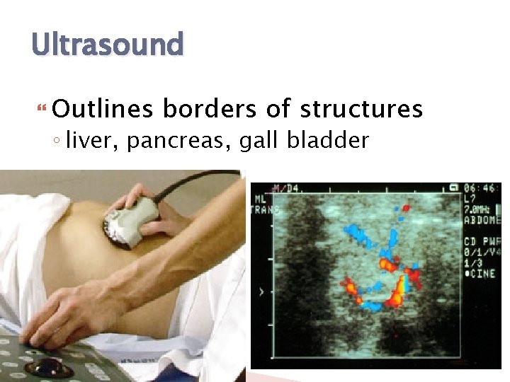 Ultrasound Outlines borders of structures ◦ liver, pancreas, gall bladder 