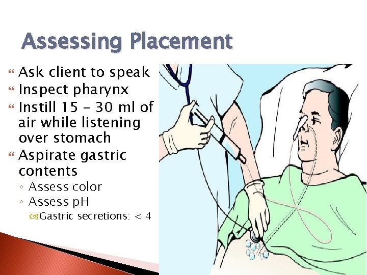 Assessing Placement Ask client to speak Inspect pharynx Instill 15 – 30 ml of