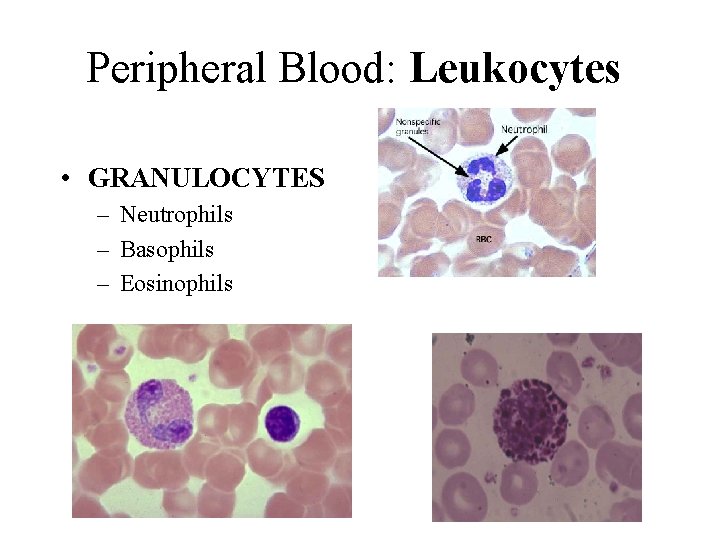 Peripheral Blood: Leukocytes • GRANULOCYTES – Neutrophils – Basophils – Eosinophils 