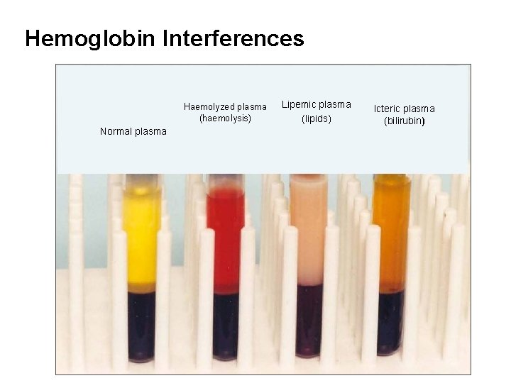 Hemoglobin Interferences Haemolyzed plasma (haemolysis) Normal plasma Lipemic plasma (lipids) Icteric plasma (bilirubin) 