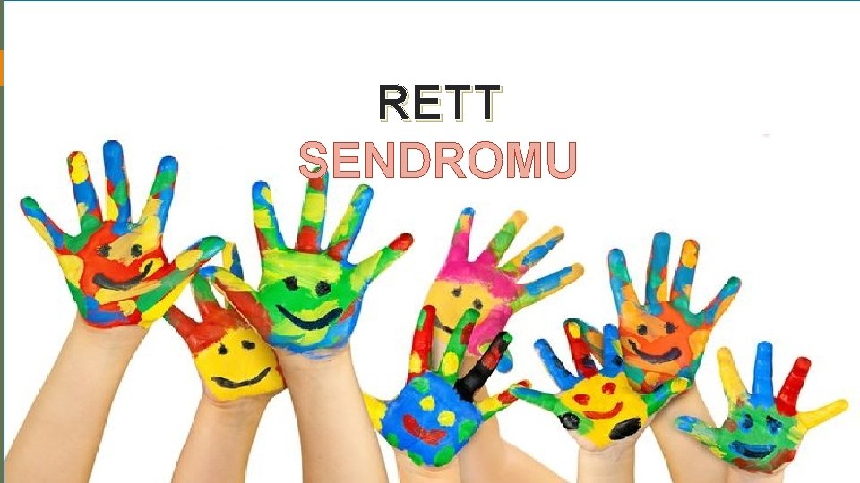 RETT SENDROMU 