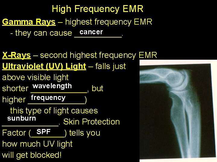 High Frequency EMR Gamma Rays – highest frequency EMR cancer - they can cause