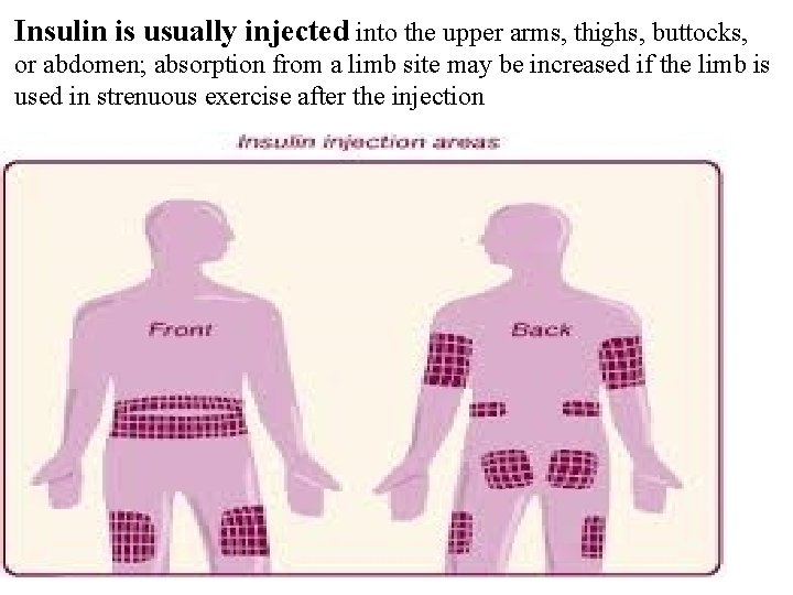 Insulin is usually injected into the upper arms, thighs, buttocks, or abdomen; absorption from