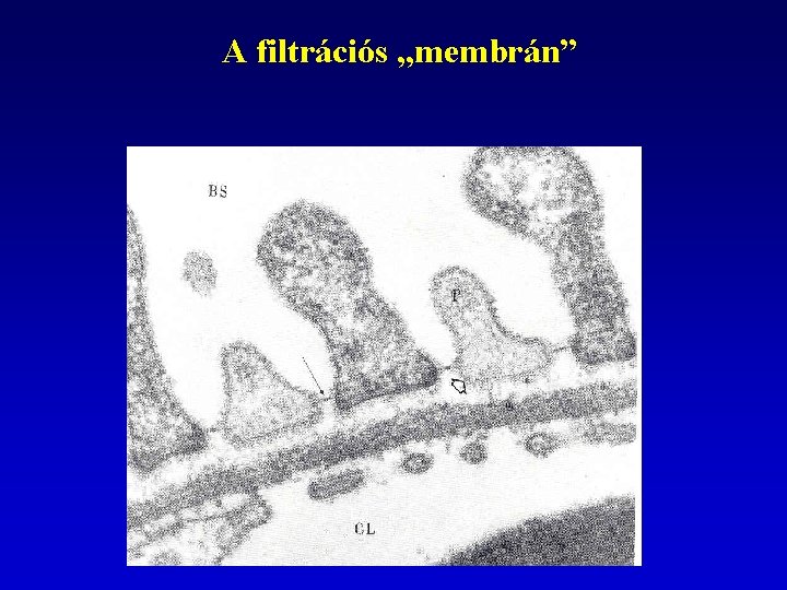 A filtrációs „membrán” 