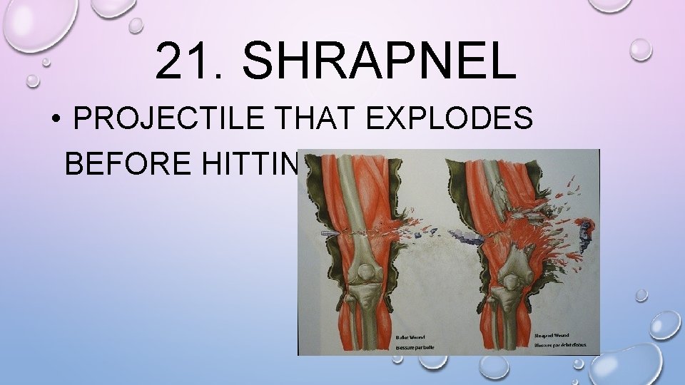 21. SHRAPNEL • PROJECTILE THAT EXPLODES BEFORE HITTING TARGET 