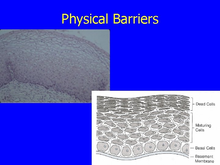 Physical Barriers 