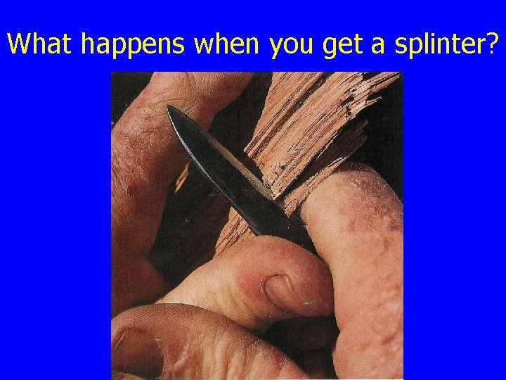 What happens when you get a splinter? 