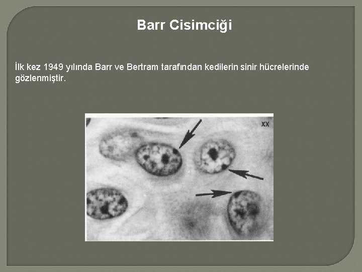 Barr Cisimciği İlk kez 1949 yılında Barr ve Bertram tarafından kedilerin sinir hücrelerinde gözlenmiştir.