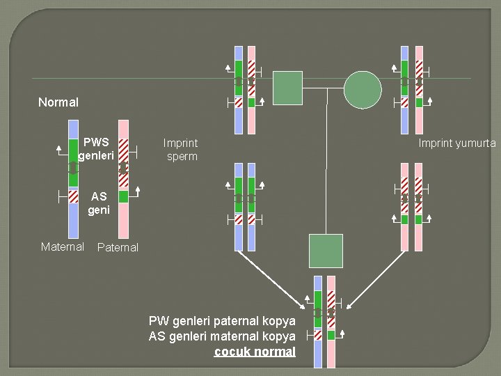 Normal PWS genleri Imprint sperm AS geni Maternal PW genleri paternal kopya AS genleri