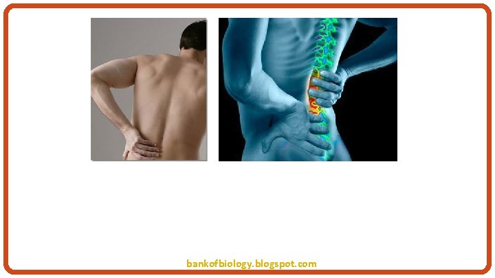 DISORDERS OF MUSCULAR AND SKELETAL SYSTEMS bankofbiology. blogspot. com 
