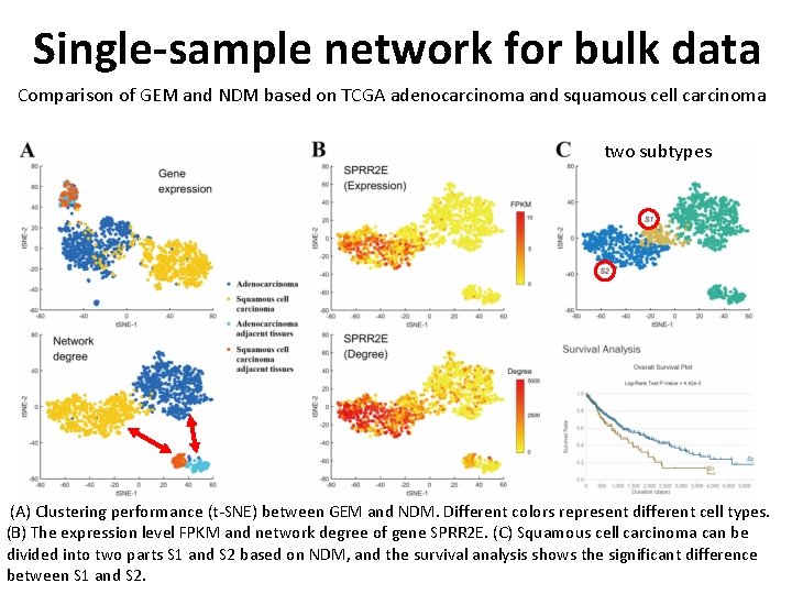 Single-sample network for bulk data Comparison of GEM and NDM based on TCGA adenocarcinoma