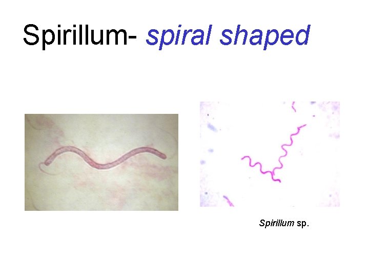Spirillum- spiral shaped Spirillum sp. 