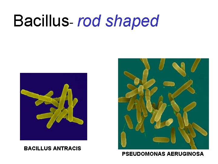 Bacillus- rod shaped BACILLUS ANTRACIS PSEUDOMONAS AERUGINOSA 