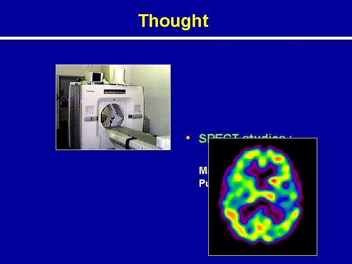 Thought • SPECT studies : Mana, vachana, kaya, Pudgala. 