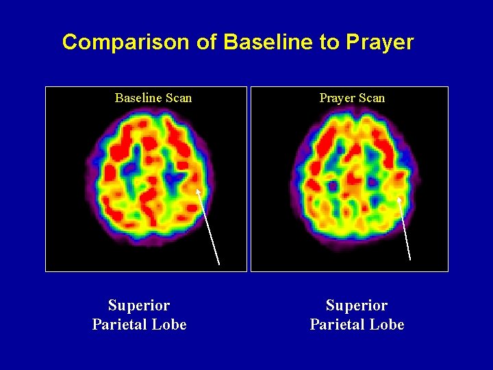 Comparison of Baseline to Prayer Baseline Scan Superior Parietal Lobe Prayer Scan Superior Parietal