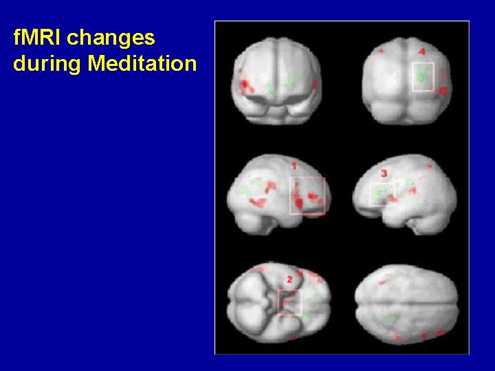 f. MRI changes during Meditation 