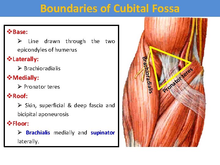 Boundaries of Cubital Fossa v. Base: Ø Line drawn through the two epicondyles of