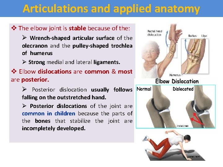 Articulations and applied anatomy v The elbow joint is stable because of the: Ø