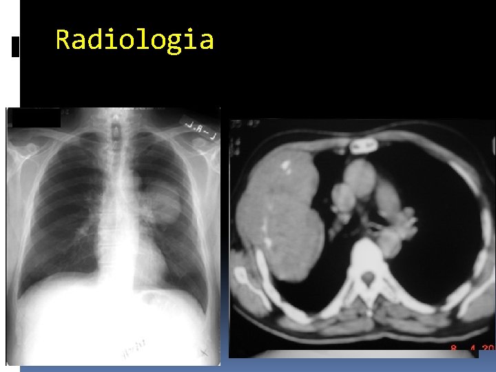 Radiologia 