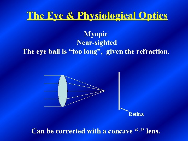 The Eye & Physiological Optics Myopic Near-sighted The eye ball is “too long”, given