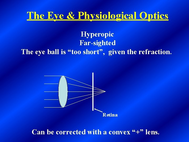 The Eye & Physiological Optics Hyperopic Far-sighted The eye ball is “too short”, given