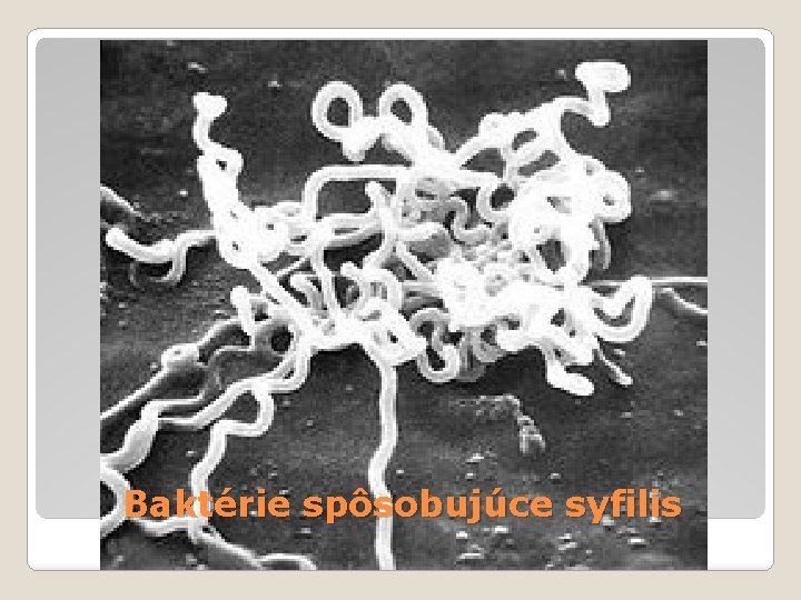 Baktérie spôsobujúce syfilis 