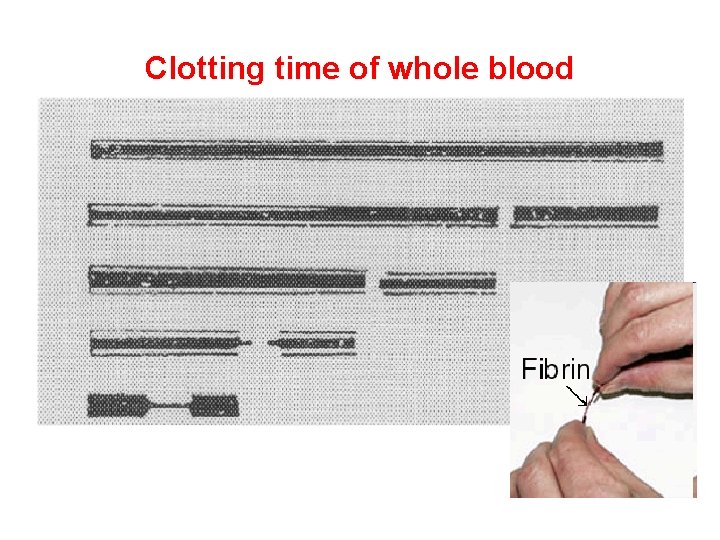 Clotting time of whole blood 