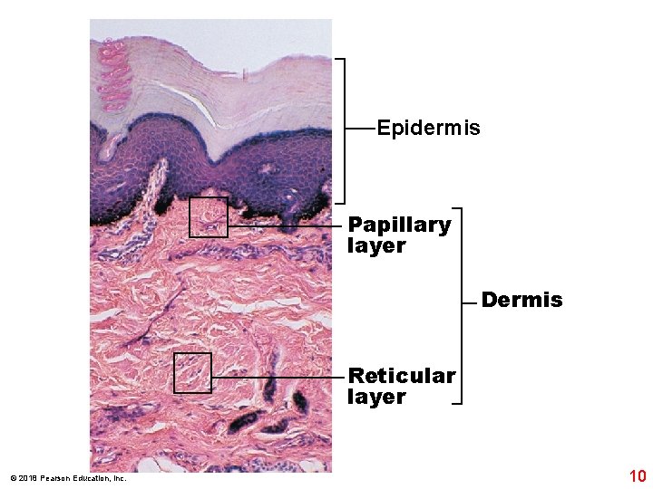 Epidermis Papillary layer Dermis Reticular layer © 2018 Pearson Education, Inc. 10 Epidermis Papillary layer Dermis Reticular layer © 2018 Pearson Education, Inc. 10