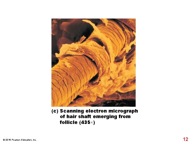 (c) Scanning electron micrograph of hair shaft emerging from follicle (435×) © 2018 Pearson