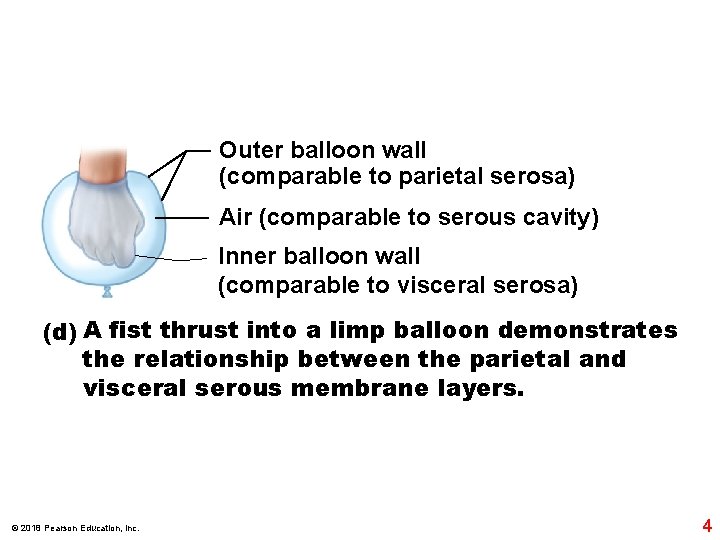 Outer balloon wall (comparable to parietal serosa) Air (comparable to serous cavity) Inner balloon