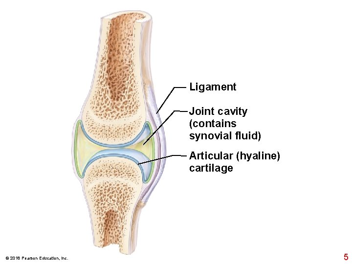Ligament Joint cavity (contains synovial fluid) Articular (hyaline) cartilage © 2018 Pearson Education, Inc. Ligament Joint cavity (contains synovial fluid) Articular (hyaline) cartilage © 2018 Pearson Education, Inc.