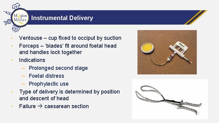 Instrumental Delivery • • • Ventouse – cup fixed to occiput by suction Forceps