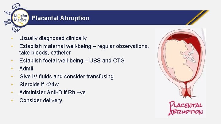 Placental Abruption • • Usually diagnosed clinically Establish maternal well-being – regular observations, take