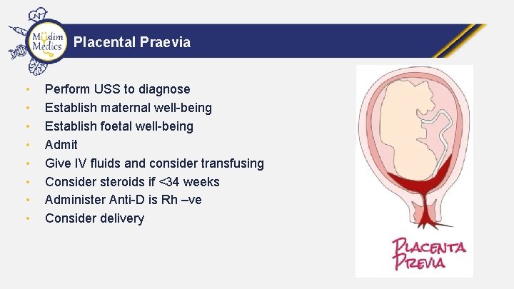 Placental Praevia • • Perform USS to diagnose Establish maternal well-being Establish foetal well-being