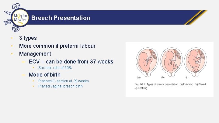 Breech Presentation • • • 3 types More common if preterm labour Management: –