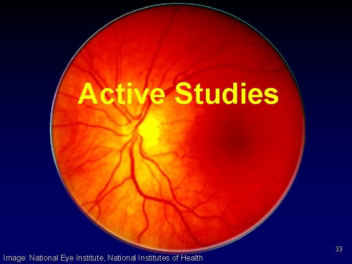 Active Studies 33 Image: National Eye Institute, National Institutes of Health 