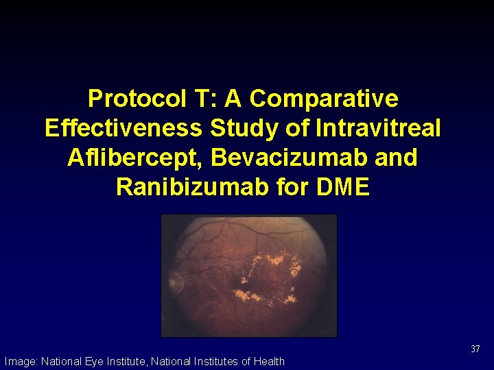 Protocol T: A Comparative Effectiveness Study of Intravitreal Aflibercept, Bevacizumab and Ranibizumab for DME