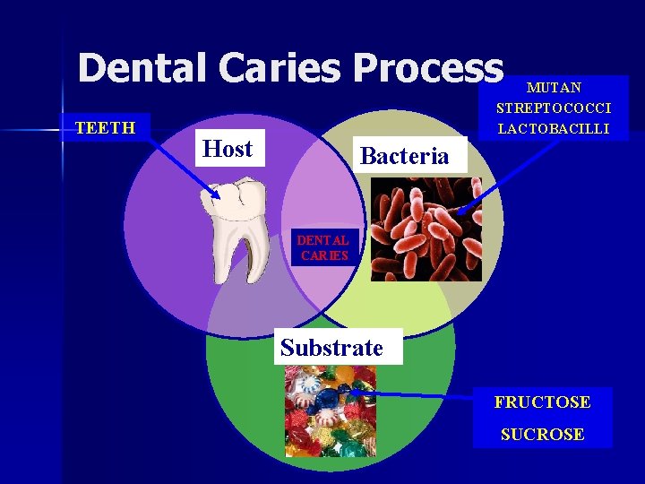 Dental Caries Process TEETH MUTAN STREPTOCOCCI LACTOBACILLI Host Bacteria DENTAL CARIES Substrate FRUCTOSE SUCROSE
